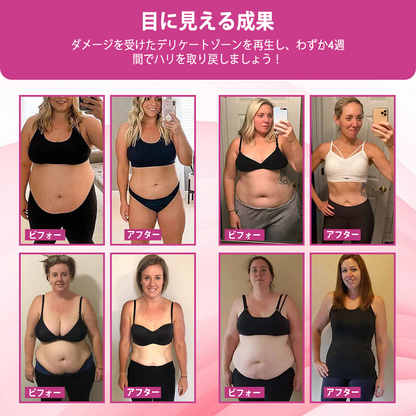 Curalona® インスタントかゆみ止め＆デトックス🏥スリミング＆引き締め再生クリームとピンク＆ソフトナチュラルPROカプセル