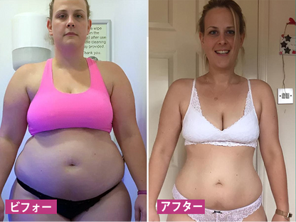 Curalona® インスタントかゆみ止め＆デトックス🏥スリミング＆引き締め再生クリームとピンク＆ソフトナチュラルPROカプセル