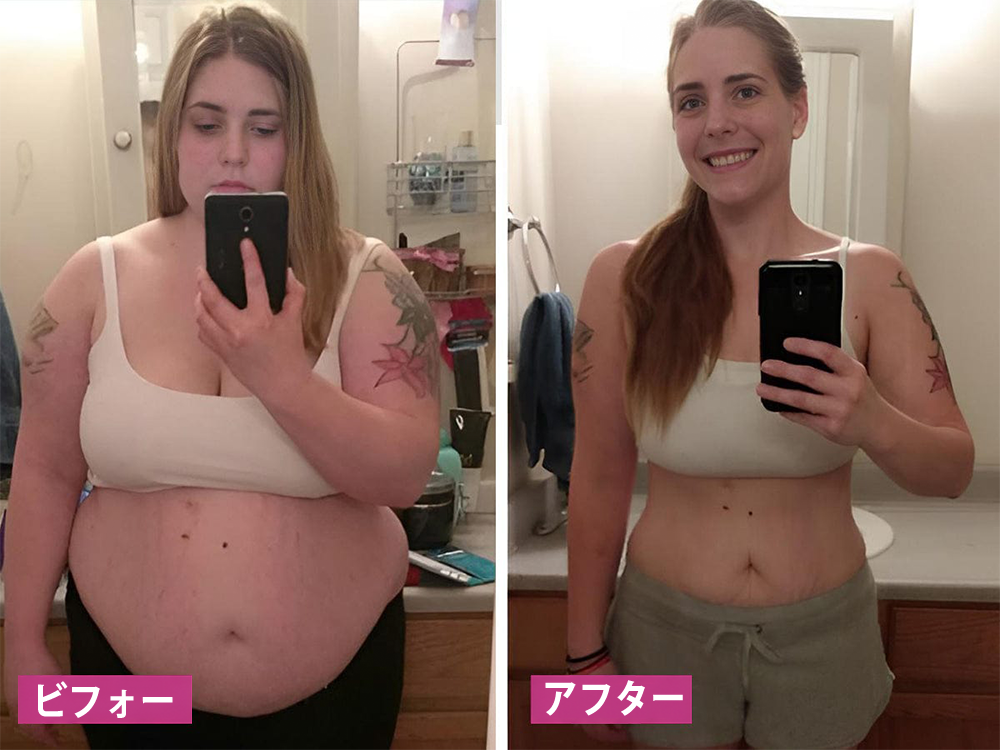 Curalona® インスタントかゆみ止め＆デトックス🏥スリミング＆引き締め再生クリームとピンク＆ソフトナチュラルPROカプセル