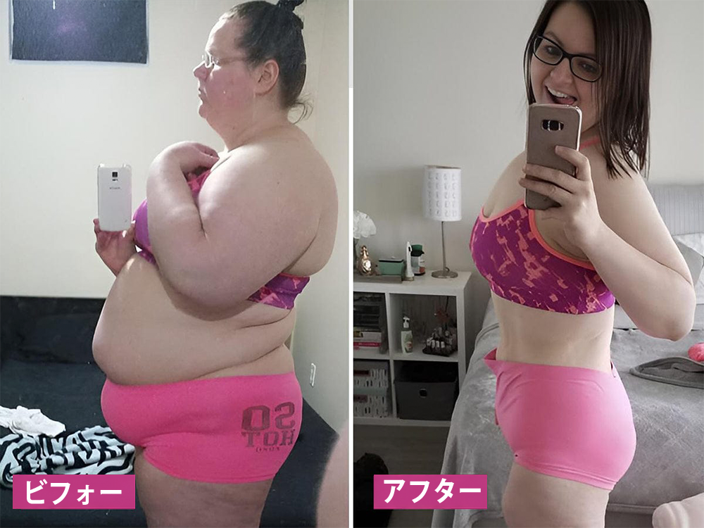 Curalona® インスタントかゆみ止め＆デトックス🏥スリミング＆引き締め再生クリームとピンク＆ソフトナチュラルPROカプセル
