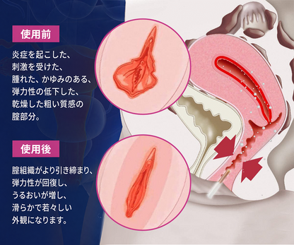 Curalona® インスタントかゆみ止め＆デトックス🏥スリミング＆引き締め再生クリームとピンク＆ソフトナチュラルPROカプセル