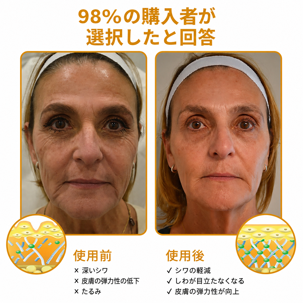 🔥セール最終日：70%割引 — Purelora® ボトックス・蜂毒配合 アンチリンクルクリーム