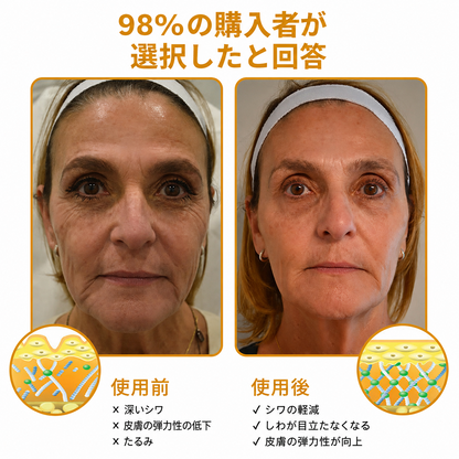 🔥セール最終日：70%割引 — Purelora® ボトックス・蜂毒配合 アンチリンクルクリーム
