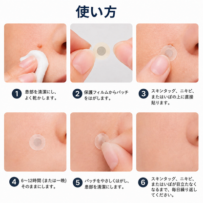 🔥Curalona® 2-in-1 マイクロニードル＆ハイドロコロイドパッチ | 🔥隆起したほくろ、ニキビ、扁平イボ、皮膚線維腫を除去 | シワ、傷跡、肌の気になる部分の改善をサポート | 顔や体に使える目立たないパッチ